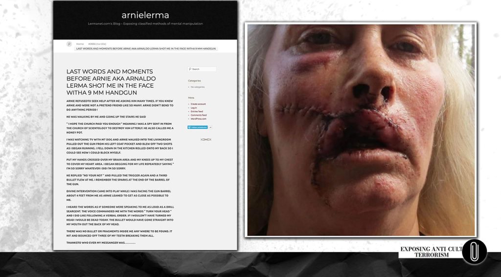 Description of the attempted murder and subsequent suicide of Arnie Lerma. Photo of his wife, Ginger Sugerman, after the described events